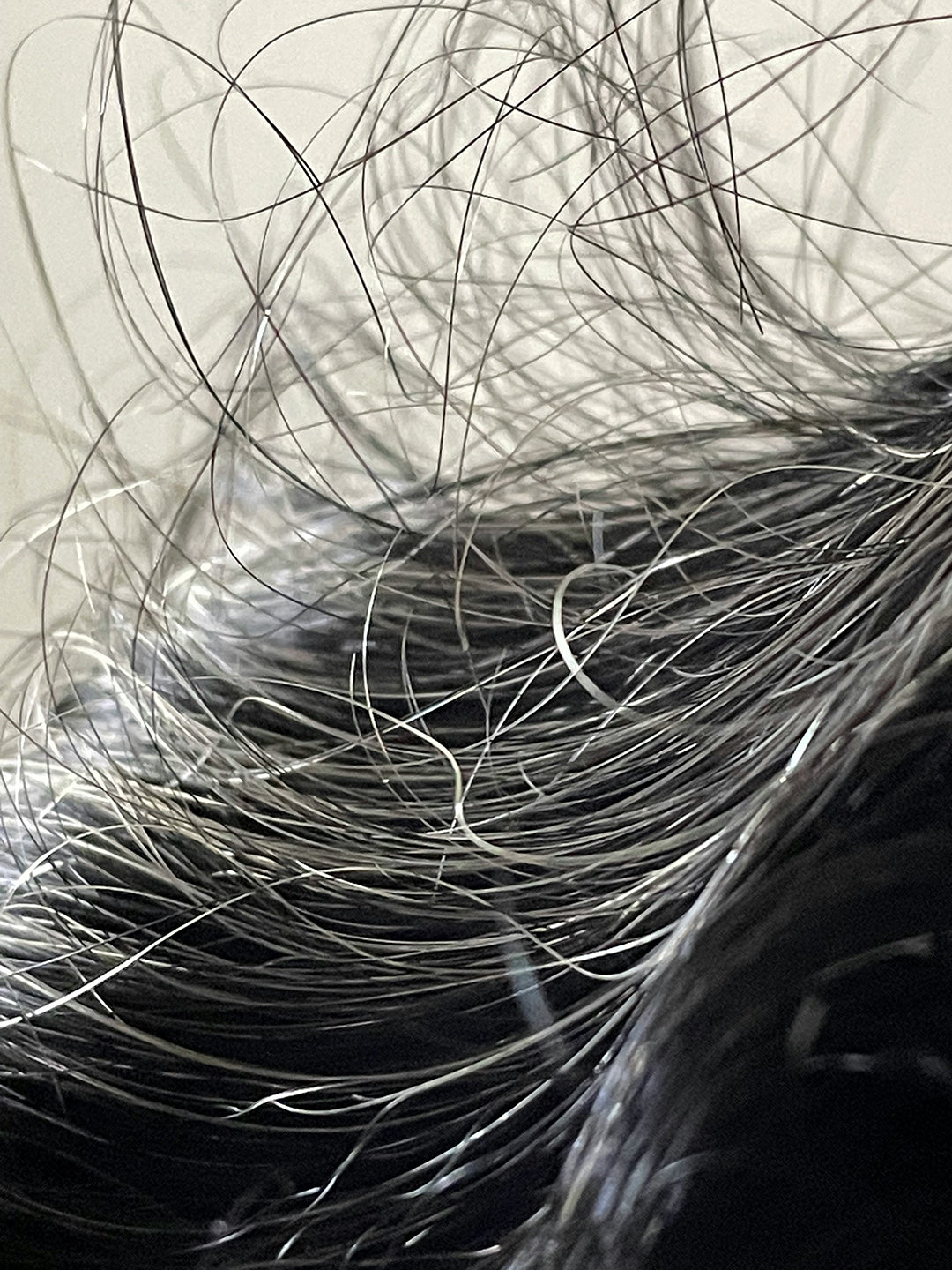 Postpartum Hair Loss